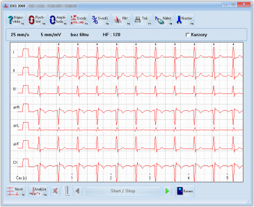 Klidové EKG - EKG 2000